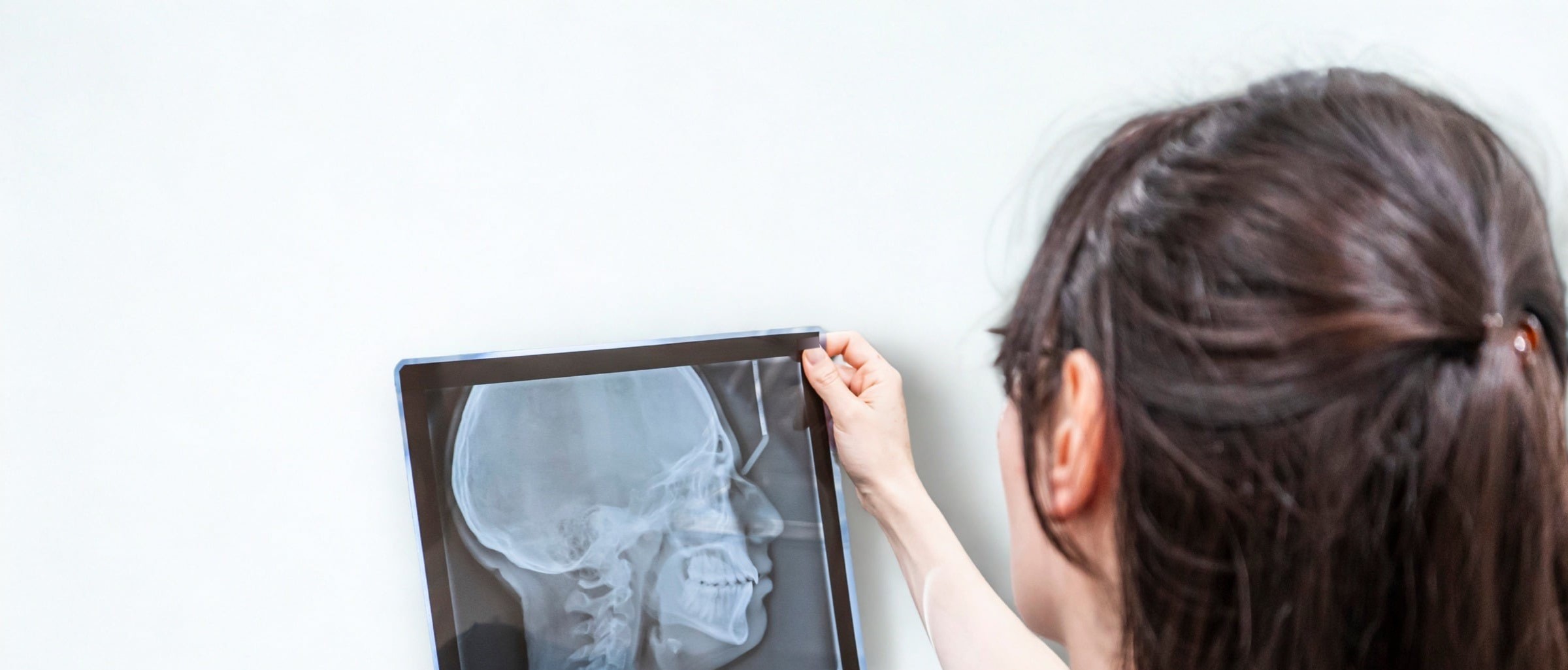 Assistente che legge una radiografia in controluce nello studio M4 Medical Clinic